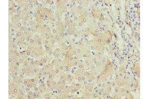 Immunohistochemistry of paraffin-embedded human liver tissue using ABIN7152640 at dilution of 1:100