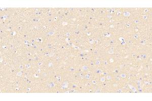 Immunohistochemistry (IHC) image for anti-Synaptosomal-Associated Protein, 25kDa (SNAP25) (AA 1-206) antibody (ABIN7443431)