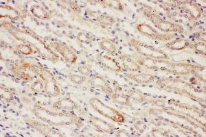 Anti-PP2A antibody, IHC(P) IHC(P): Rat Kidney Tissue (PPP2CA Antikörper  (N-Term))