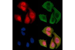 ABIN6256440 and ABIN6267350 staining Hela cells(30 min of UV treatment) by IF/ICC. (Bcl-2 Antikörper  (pSer87))