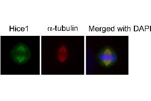 Immunofluorescence analysis of human osteosarcoma cell line U2OS, using HICE1 antibody at 1:50-1:200 dilution. (NYS48/HAUS8 Antikörper)