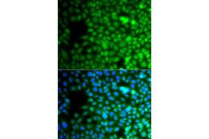 Immunofluorescence analysis of A549 cell using ZNF195 antibody.