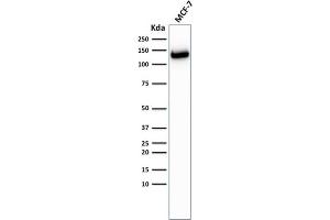Western Blotting (WB) image for anti-Cadherin 1, Type 1, E-Cadherin (Epithelial) (CDH1) antibody (ABIN6941299)