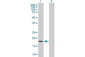 Western Blot analysis of PTP4A1 expression in transfected 293T cell line by PTP4A1 MaxPab polyclonal antibody. (PTP4A1 Antikörper  (AA 1-173))