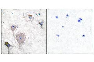 Immunohistochemistry (IHC) image for anti-Peripherin (PRPH) (C-Term) antibody (ABIN1848740) (Peripherin Antikörper  (C-Term))