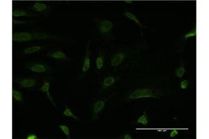 Immunofluorescence of monoclonal antibody to BCL9 on HeLa cell. (BCL9 Antikörper  (AA 1036-1135))