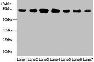 Western blot All lanes: CLGN antibody at 7 μg/mL Lane 1: Mouse brain tissue Lane 2: Mouse lung tissue Lane 3: Jurkat whole cell lysate Lane 4: HepG2 whole cell lysate Lane 5: PC-3 whole cell lysate Lane 6: Hela whole cell lysate Lane 7: HL60 whole cell lysate Secondary Goat polyclonal to rabbit IgG at 1/10000 dilution Predicted band size: 71, 47 kDa Observed band size: 80 kDa (Calmegin Antikörper  (AA 200-400))