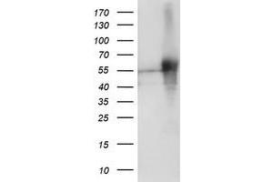 Western Blotting (WB) image for anti-SH2 Domain Protein 2A (SH2D2A) antibody (ABIN1500914) (SH2D2A Antikörper)
