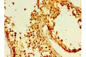 Immunohistochemistry of paraffin-embedded human testis tissue using ABIN7173881 at dilution of 1:100 (Ectodysplasin A2 Receptor Antikörper  (AA 1-138))