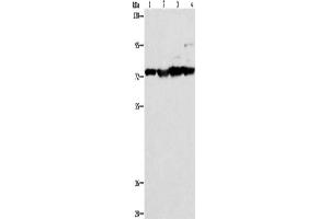 Western Blotting (WB) image for anti-Matrix Metallopeptidase 15 (Membrane-inserted) (MMP15) antibody (ABIN2421859) (MMP15 Antikörper)