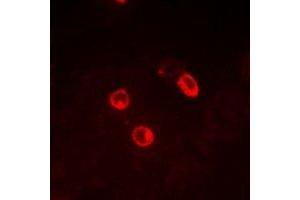 Immunofluorescent analysis of CG alpha staining in MCF7 cells. (CGA Antikörper)