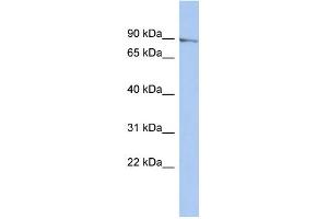 WB Suggested Anti-MLH1 Antibody Titration: 0.