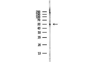 Western blot analysis of lysates from Hela cells(starvation,24h treatment), using MEF2C Antibody at 1/1000 dilution.