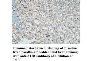 Image no. 1 for anti-alpha-1-B Glycoprotein (A1BG) antibody (ABIN791226) (A1BG Antikörper)