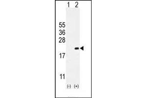 Western blot analysis of CDKN2C (arrow) using rabbit polyclonal CDKN2C Antibody (C-term) (ABIN654908 and ABIN2844555). (CDKN2C Antikörper  (C-Term))