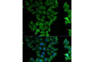 Immunofluorescence analysis of MCF7 cells using ELF3 Polyclonal Antibody (ELF3 Antikörper)