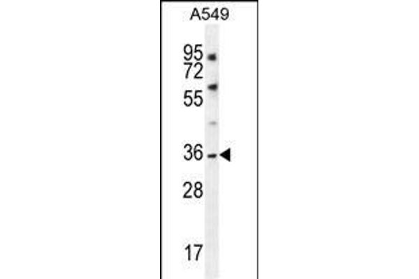 KCNK1 Antikörper  (C-Term)