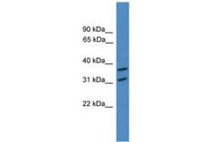 Image no. 1 for anti-OTU Domain Containing 6A (OTUD6A) (AA 51-100) antibody (ABIN6745381) (OTUD6A Antikörper  (AA 51-100))