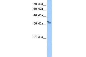 WB Suggested Anti-PCMTD1 Antibody Titration:  2. (PCMTD1 Antikörper  (Middle Region))