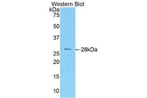 Western Blotting (WB) image for anti-Melanoma Cell Adhesion Molecule (MCAM) (AA 324-565) antibody (ABIN1859776) (MCAM Antikörper  (AA 324-565))