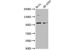 Western Blot Positive WB detected in: Hela whole cell lysate, SH-SY5Y whole cell lysate All lanes: PDE6C antibody at 3. (PDE6C Antikörper  (AA 285-451))