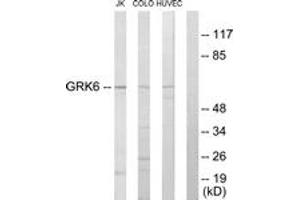 Western blot analysis of extracts from Jurkat/COLO205/HuvEc cells, using GRK6 Antibody. (GRK6 Antikörper  (AA 10-59))