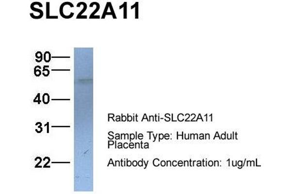SLC22A11 anticorps  (C-Term)