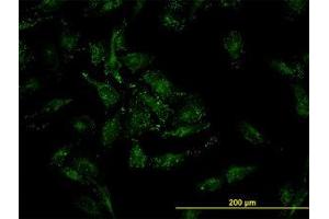 Image no. 3 for anti-Cofilin 2 (CFL2) (AA 57-167) antibody (ABIN598607) (Cofilin 2 Antikörper  (AA 57-167))