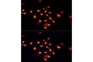 Immunofluorescence analysis of C6 cells using GTF3C4 Polyclonal Antibody  at dilution of 1:100 (40x lens). (GTF3C4 Antikörper  (AA 583-822))