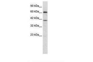 Image no. 2 for anti-PR Domain Containing 14 (PRDM14) (AA 208-257) antibody (ABIN202775)