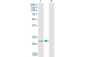 Western Blot analysis of CTF1 expression in transfected 293T cell line by CTF1 MaxPab polyclonal antibody. (Cardiotrophin 1 Antikörper  (AA 1-201))