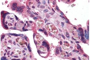 Human Placenta: Formalin-Fixed, Paraffin-Embedded (FFPE) (Transferrin Receptor Antikörper  (AA 169-377))