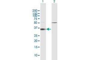 Western Blot analysis of SLC14A1 expression in transfected 293T cell line by SLC14A1 MaxPab polyclonal antibody. (SLC14A1 Antikörper  (AA 1-389))