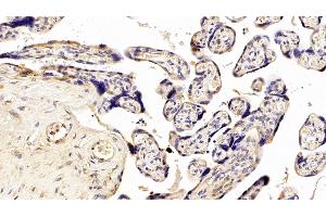 Detection of NEU in Human Placenta Tissue using Polyclonal Antibody to Neuraminidase (NEU) (NEU1 Antikörper  (AA 47-415))