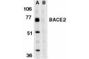 Western blot analysis of BACE2 in human heart tissue lysate in the absence (A) or presence (B) of blocking peptide with AP30113PU-N BACE2 antibody at 1 μg/ml. (BACE2 Antikörper  (C-Term))