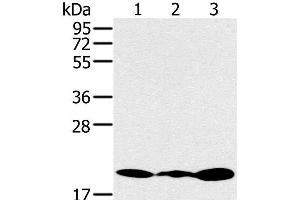 Western Blot analysis of Jurkat, 231 and K562 cell using RNF5 Polyclonal Antibody at dilution of 1:200 (RNF5 Antikörper)