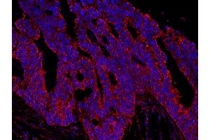 Immunofluorescence (IF) image for anti-A Kinase (PRKA) Anchor Protein 1 (AKAP1) (AA 375-425) antibody (ABIN7448928) (AKAP1 Antikörper  (AA 375-425))