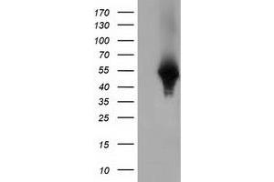 Western Blotting (WB) image for anti-Haptoglobin (HP) antibody (ABIN1498579) (Haptoglobin Antikörper)
