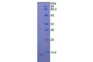 Image no. 1 for S100 Calcium Binding Protein B (S100B) (AA 1-92) (Active) protein (His tag) (ABIN6239831) (S100B Protein (AA 1-92) (His tag))