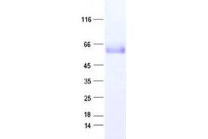 Validation with Western Blot