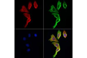ABIN6265740 and ABIN6273021 staining Hela cells by IF/ICC. (TRIM44 Antikörper  (Internal Region))
