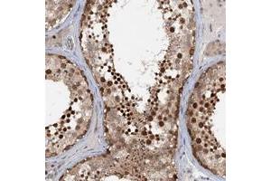 Immunohistochemical staining of human testis with TAS2R42 polyclonal antibody  shows strong nuclear positivity in cells of seminiferus ducts at 1:50-1:200 dilution.