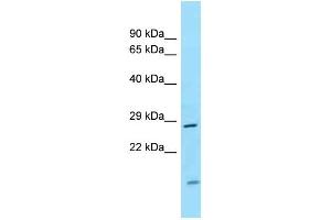 WB Suggested Anti-CD82 Antibody Titration: 1. (CD82 Antikörper  (Middle Region))