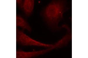 Immunofluorescence (IF) image for anti-Nuclear Factor-kB p65 (NFkBP65) (pSer529) antibody (ABIN1870581) (NF-kB p65 Antikörper  (pSer529))