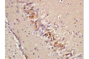 Formalin-fixed and paraffin embedded rat brain labeled with Rabbit Anti-Epac2 Polyclonal Antibody, Unconjugated (ABIN2173847) at 1:200 followed by conjugation to the secondary antibody and DAB staining (RAPGEF4 Antikörper  (AA 151-250))