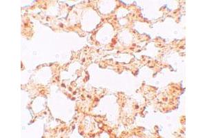 Immunohistochemical staining of mouse lung cells with SLC39A6 polyclonal antibody  at 5 ug/mL. (SLC39A6 Antikörper  (Internal Region))