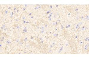 Detection of SIRT2 in Mouse Cerebrum Tissue using Polyclonal Antibody to Sirtuin 2 (SIRT2) (SIRT2 Antikörper  (AA 65-340))