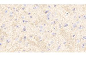 Detection of SIRT2 in Mouse Cerebrum Tissue using Polyclonal Antibody to Sirtuin 2 (SIRT2)