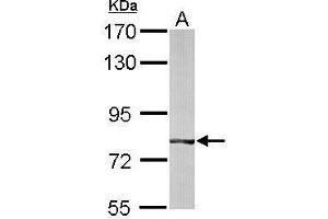 WB Image Sample (50 ug of whole cell lysate) A: mouse liver 7. (BBS7 Antikörper)