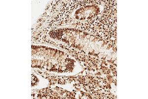 Immunohistochemical analysis of paraffin-embedded Human colon tissue using A performed on the Leica® BOND RXm.